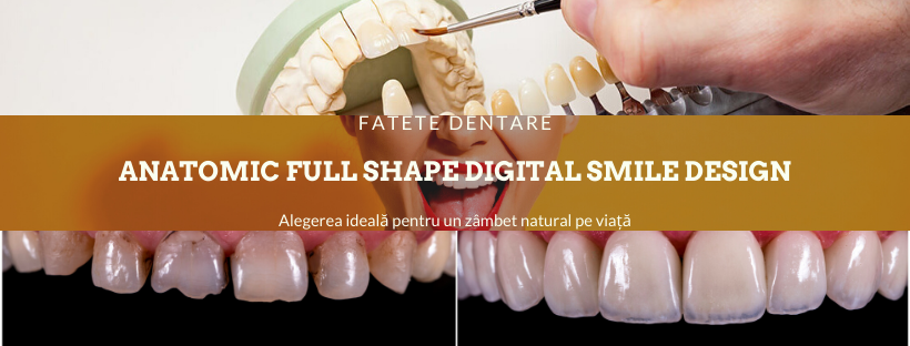 fatete dentare premium Anatomic Full shape DSD Davinci